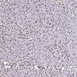 NOB1 Antibody, Novus Biologicals 25 &mu;L, Unlabeled:Antibodies, Polyclonal